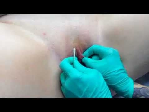 darcy leslie recommends clitoral piercing video pic